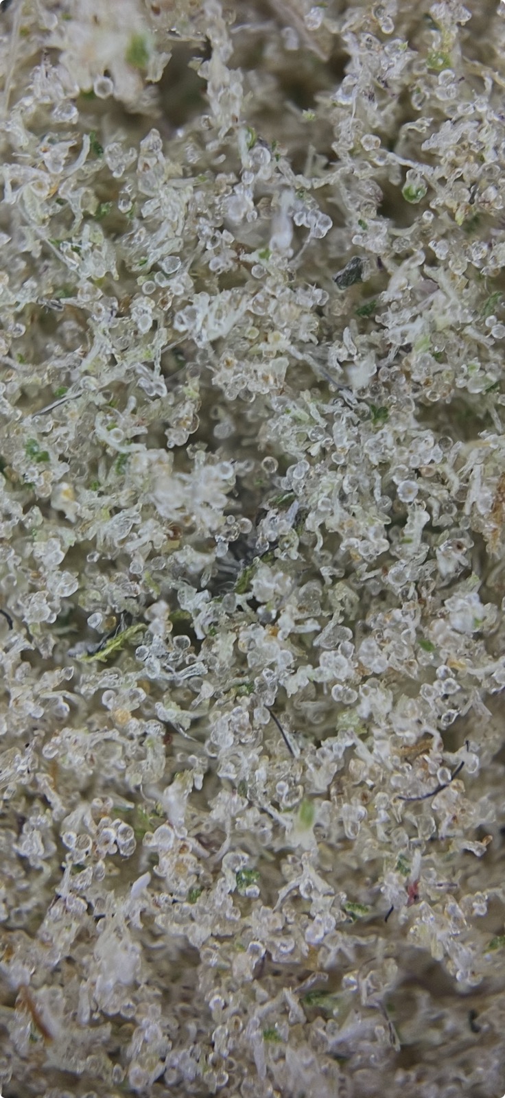 Dry Sift unter dem Mikroskop bei 200-facher Vergrößerung mit Trichomköpfen und Pflanzenresten
